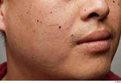 Man Asian Chubby Face Skin Textures